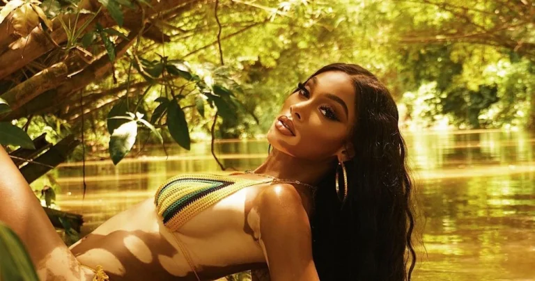 Вінні Гарлоу: аутоімунна дисфункція — не вирок